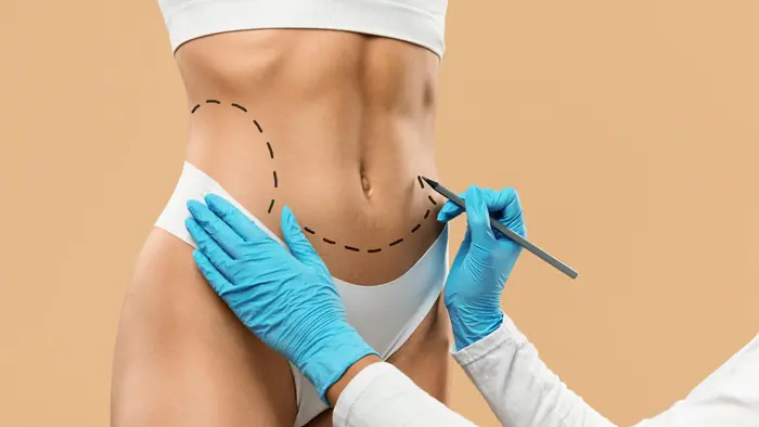 Liposuction and Fat Grafting: A Surgical Overview